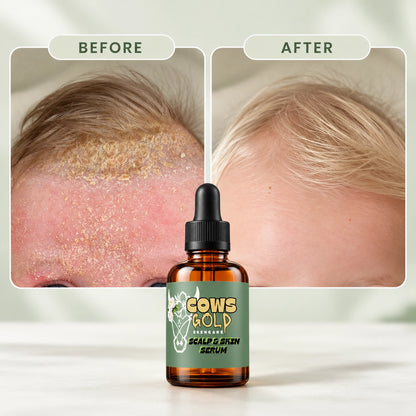 SCALP & SKIN SERUM