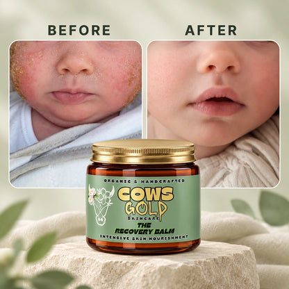 THE RECOVERY BALM